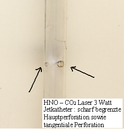 Jet-Katheter laserresistent