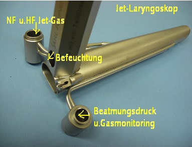 Jet-Laryngoskop